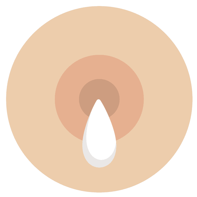 Medium Shade Breast